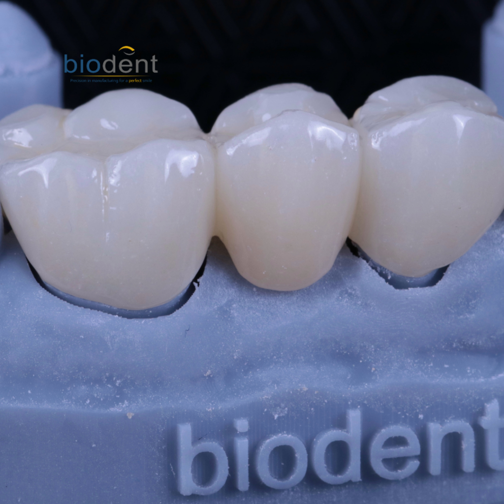 Implant supported screw retained- zirconia