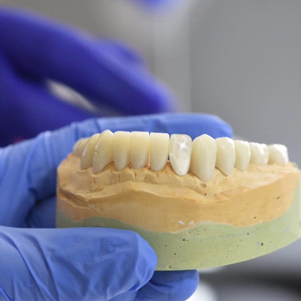 Biodent Diamondera ™